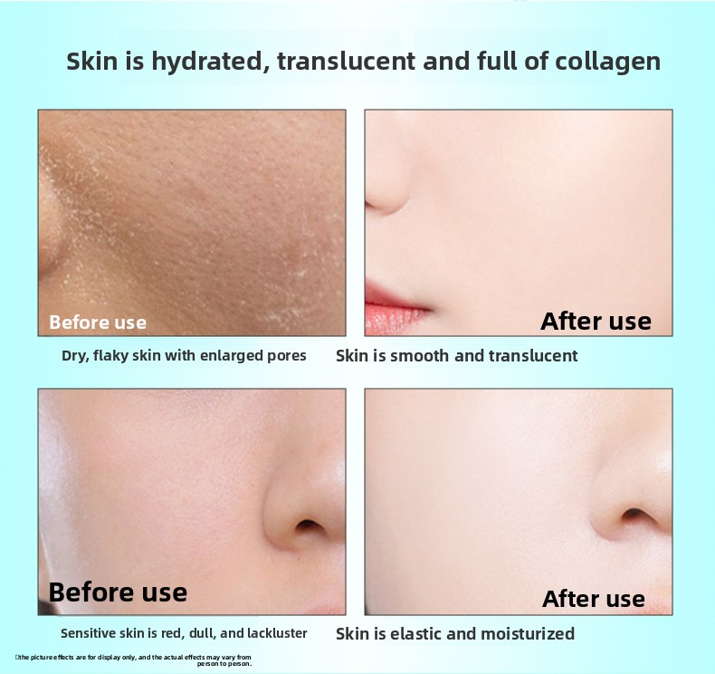Before and after using FKY soluble collagen patch - hydrated, translucent skin