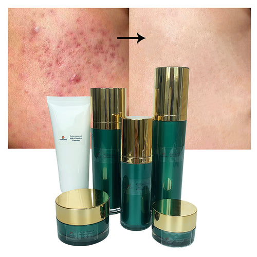 5-Step Skin Care Set - Clearer Look with Tea Tree