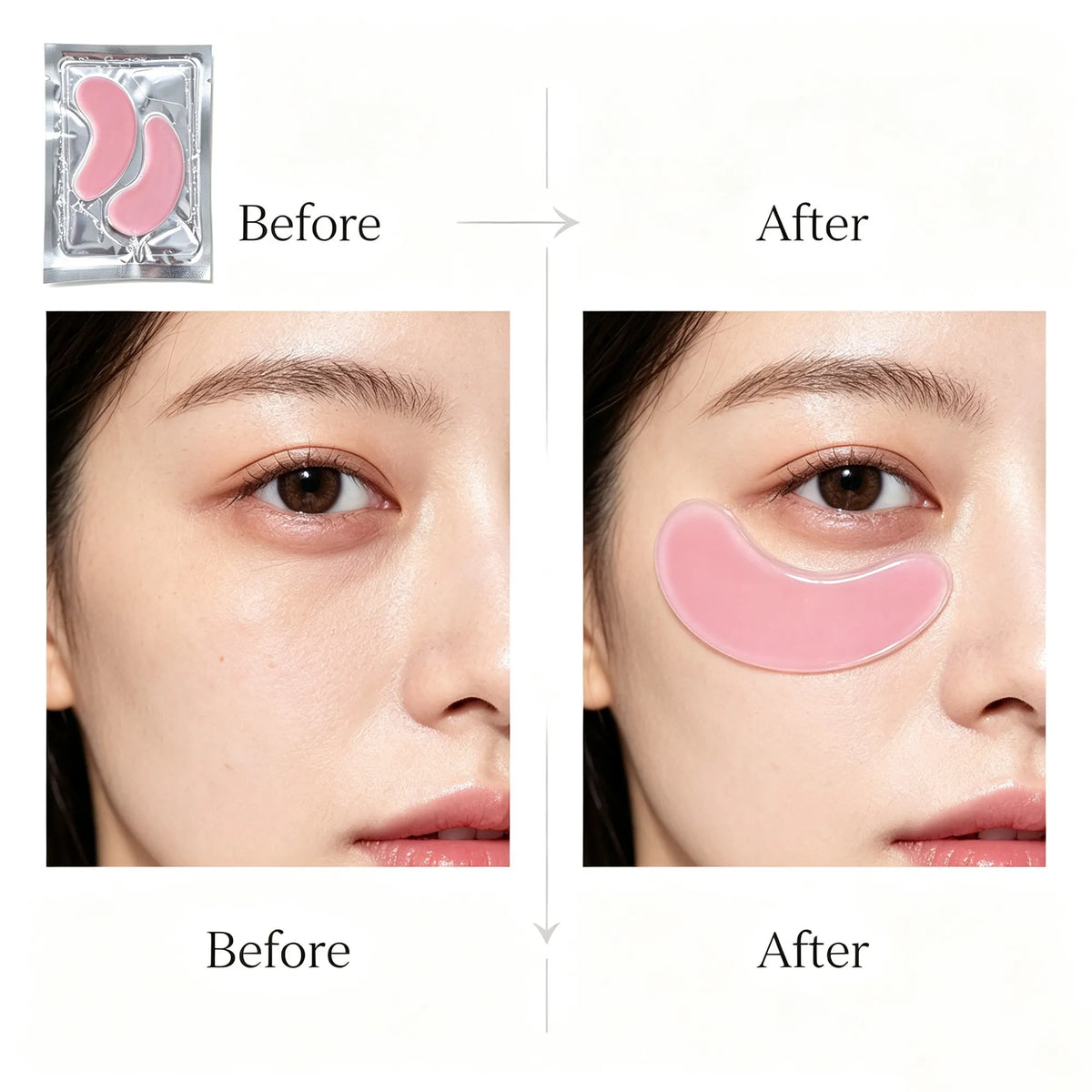 Before and after using FKY hydrogel eye patch under the eye
