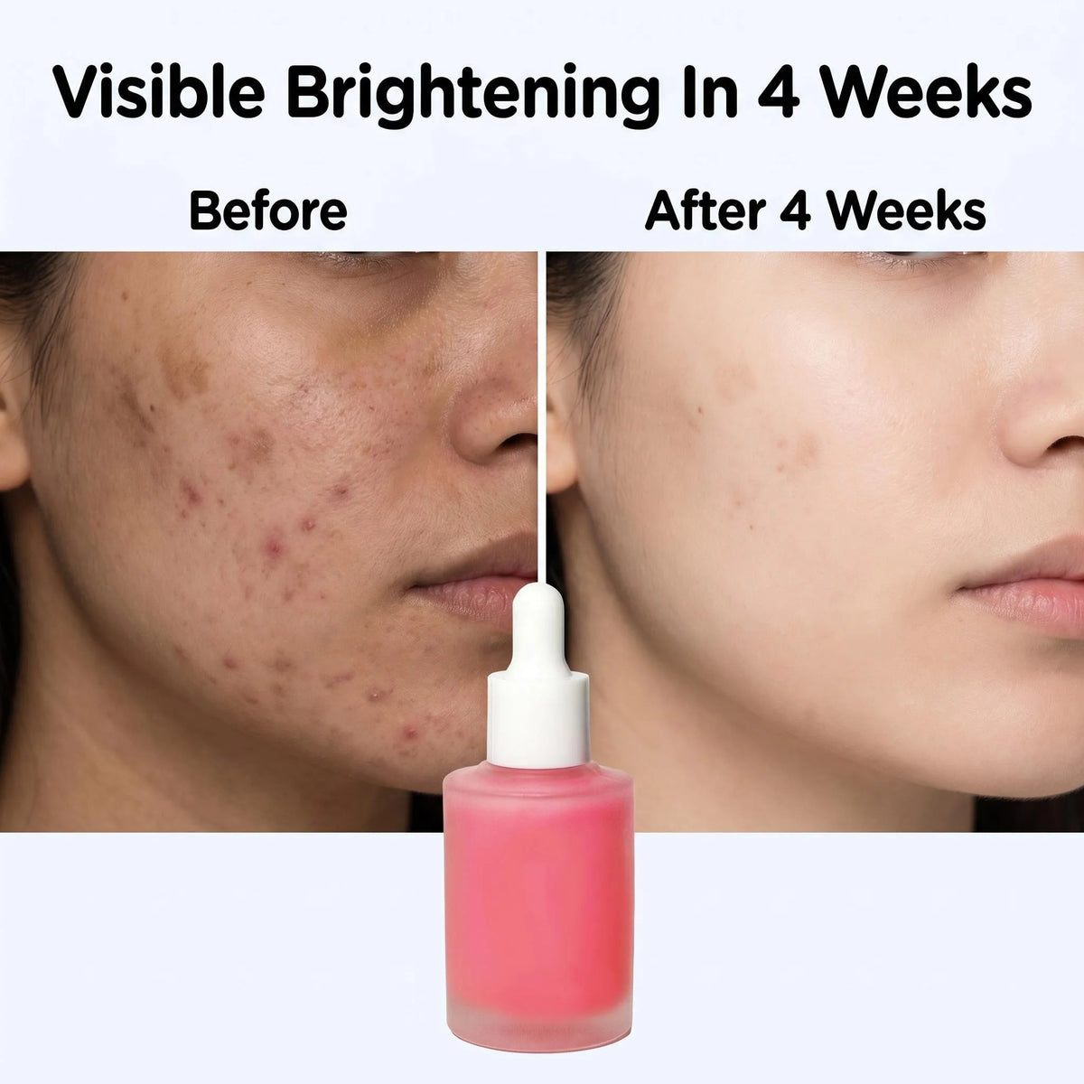 Alpha Arbutin + Niacinamide Brightening Serum