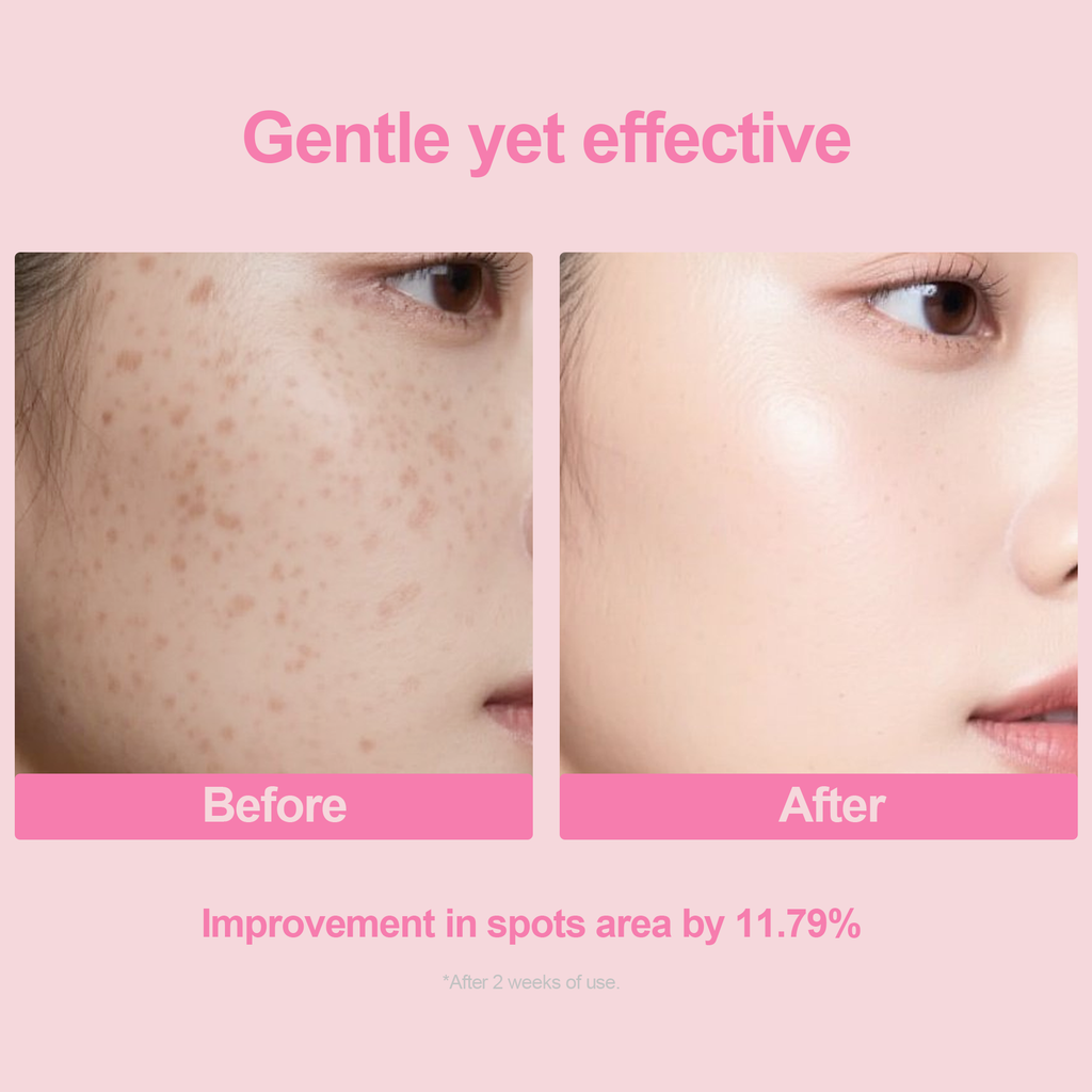 Salmon DNA PDRN Pink Repair Probiotic Ampoule Serum