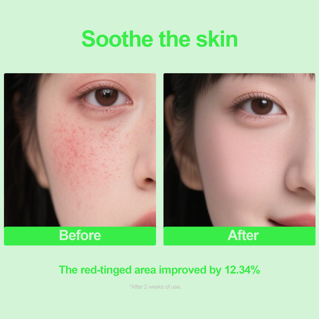 Ceramide Soothing Probiotic Ampoule Serum