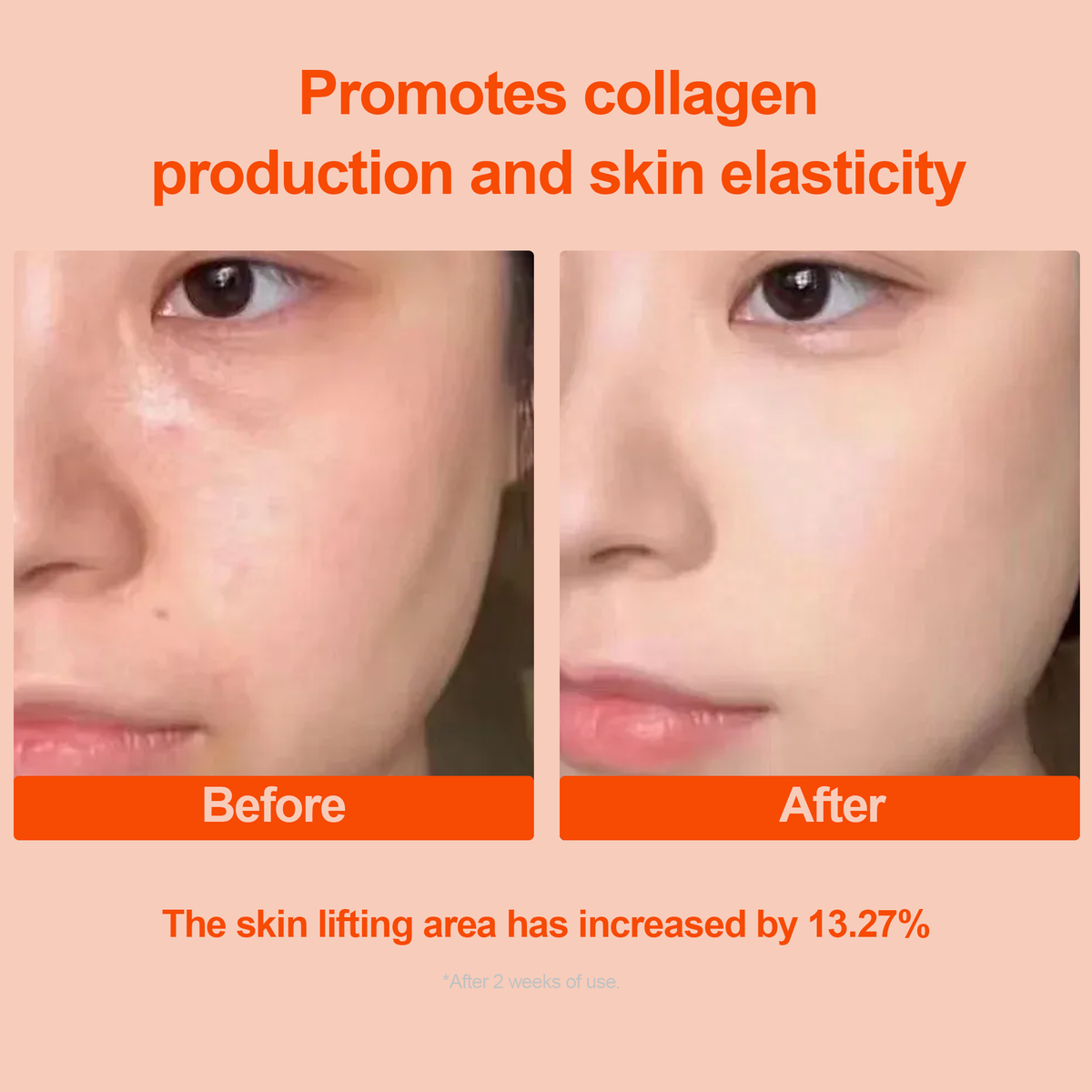 Ectoin Probiotic Ampoule Serum for Firmer-Looking Skin