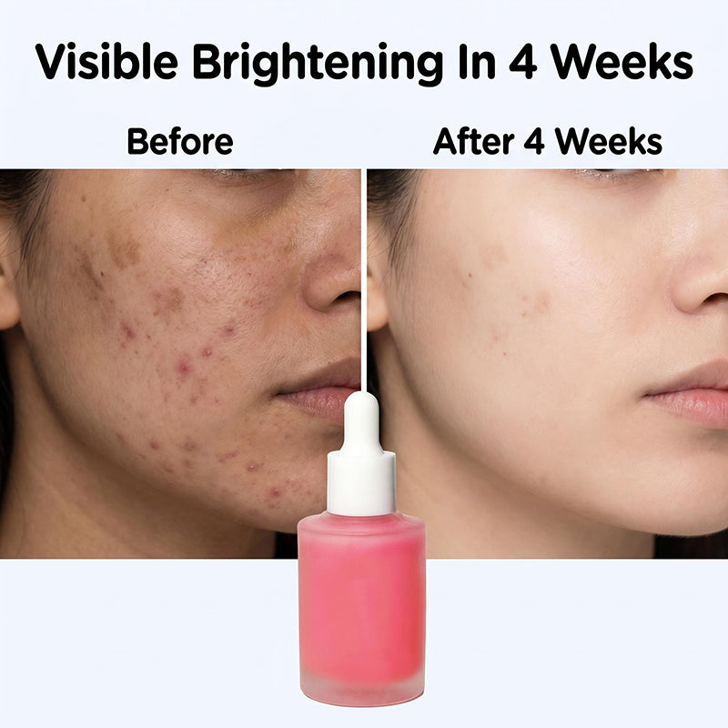 Alpha Arbutin + Niacinamide Brightening Serum